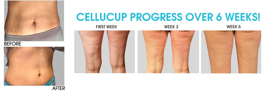 Cellu-Cup-5-min Cellu-Cup Original | Cellu-cup