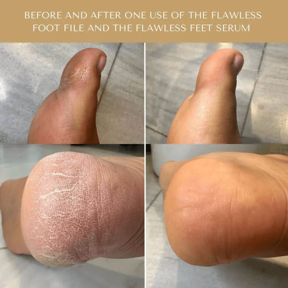 FootSerum2-min