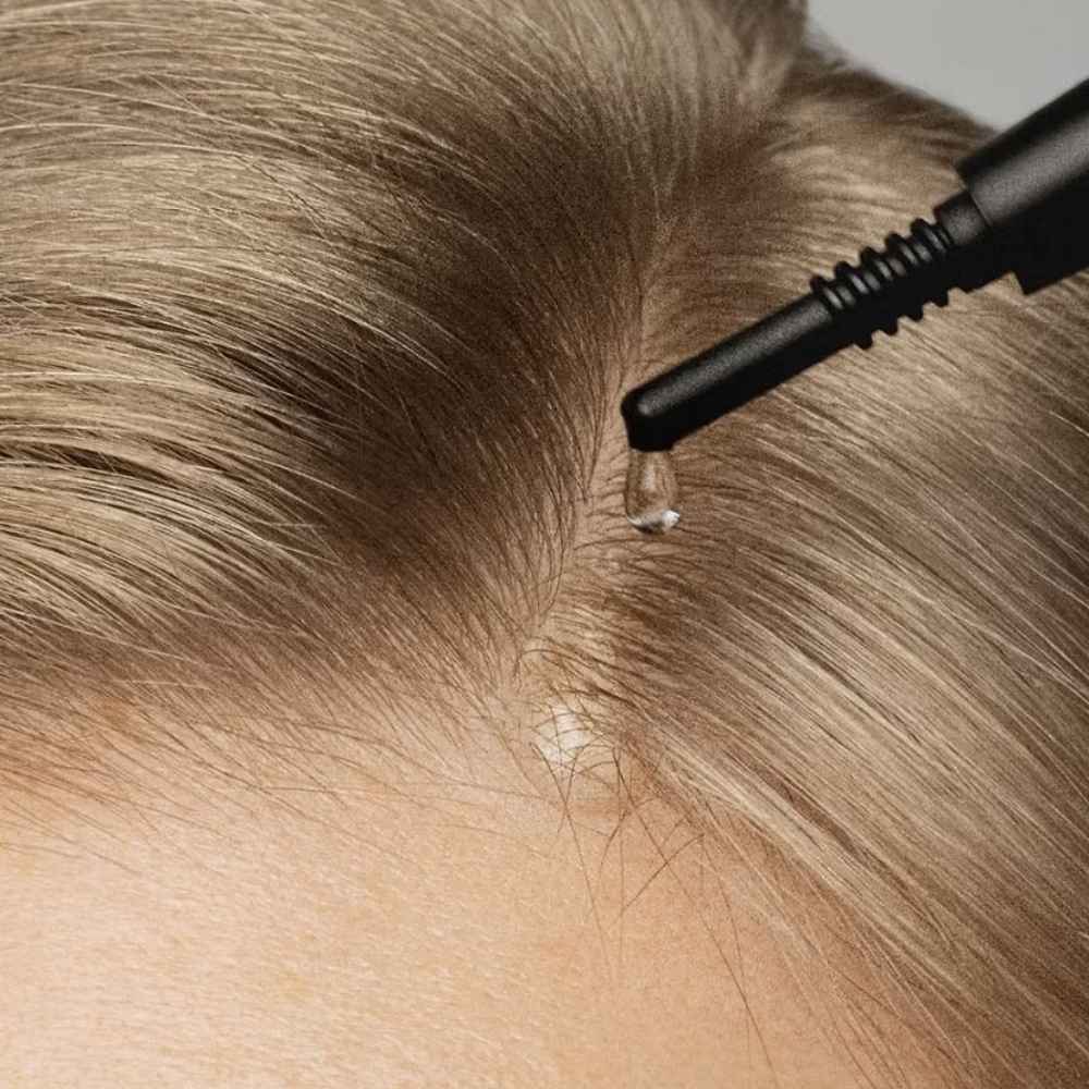 Scalp Peel Serum Scalp Peel Serum