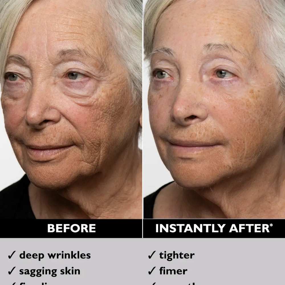 Instant FIRMx Temporary Face Tightener