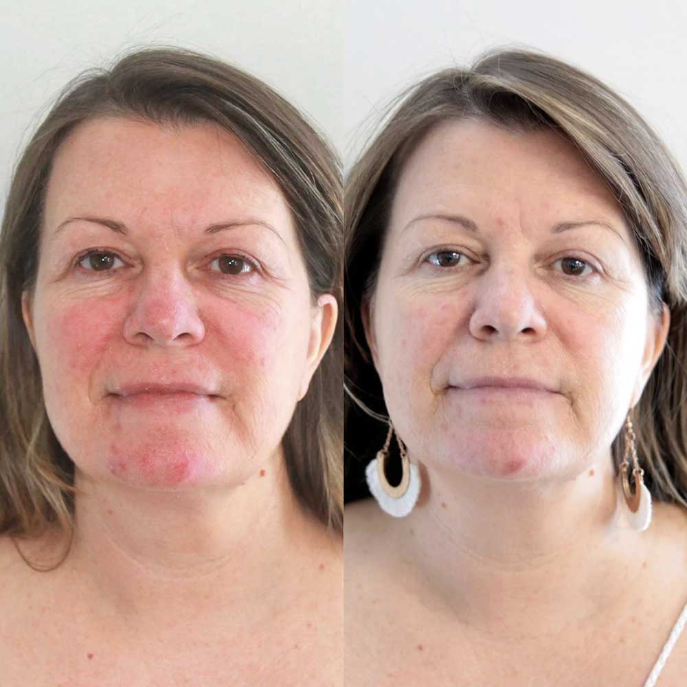 eco-by-sonya-skin-compost-collection-trio-gesichtspflege-3