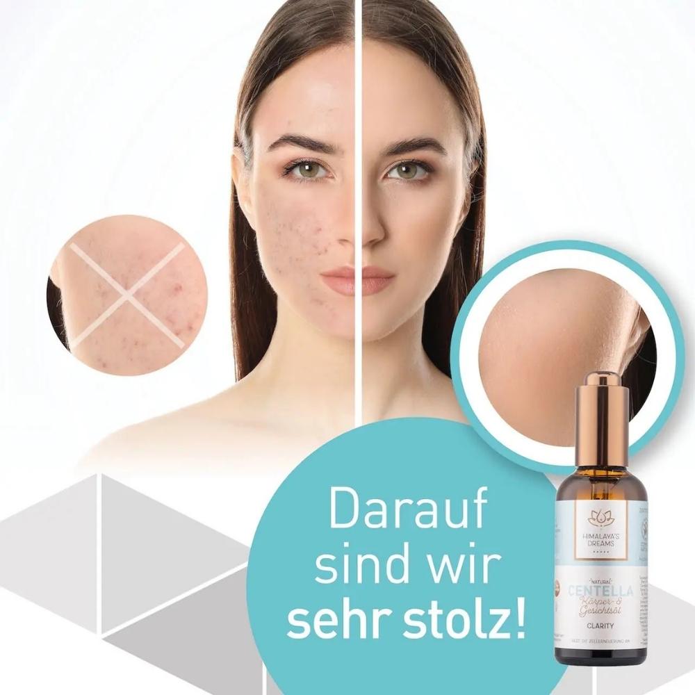 Clarity Centella Körper- und Gesichtöl