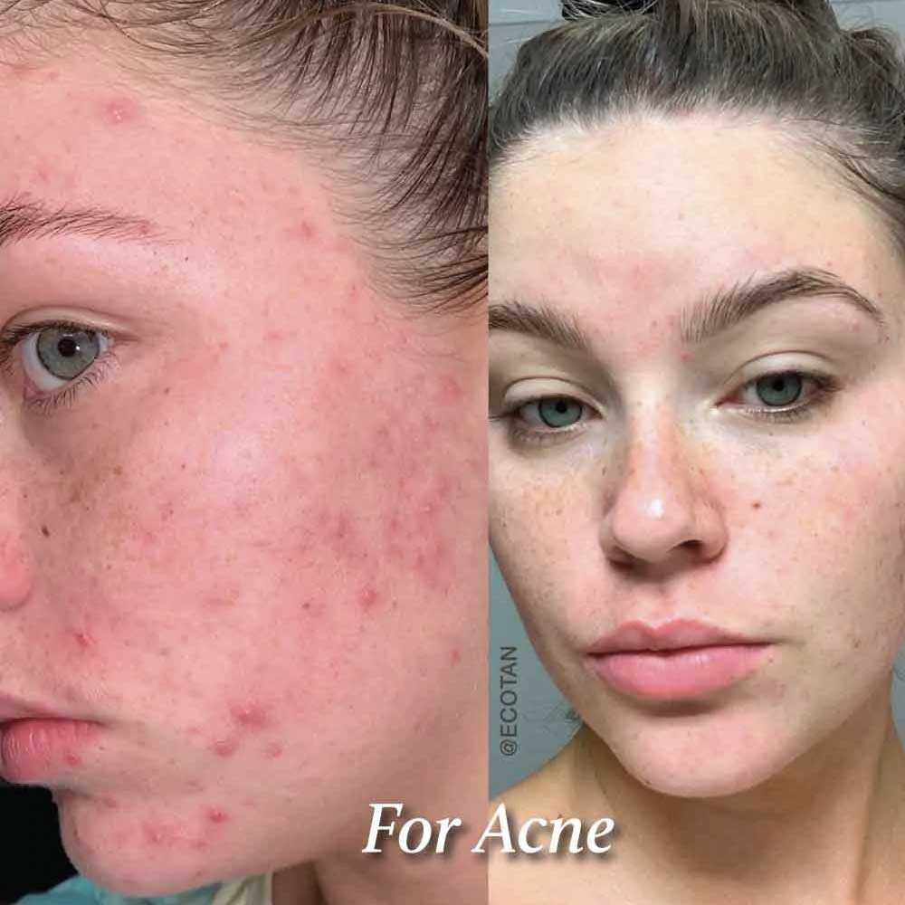 eco-by-sonya-glory-oil-ergebnisse-2