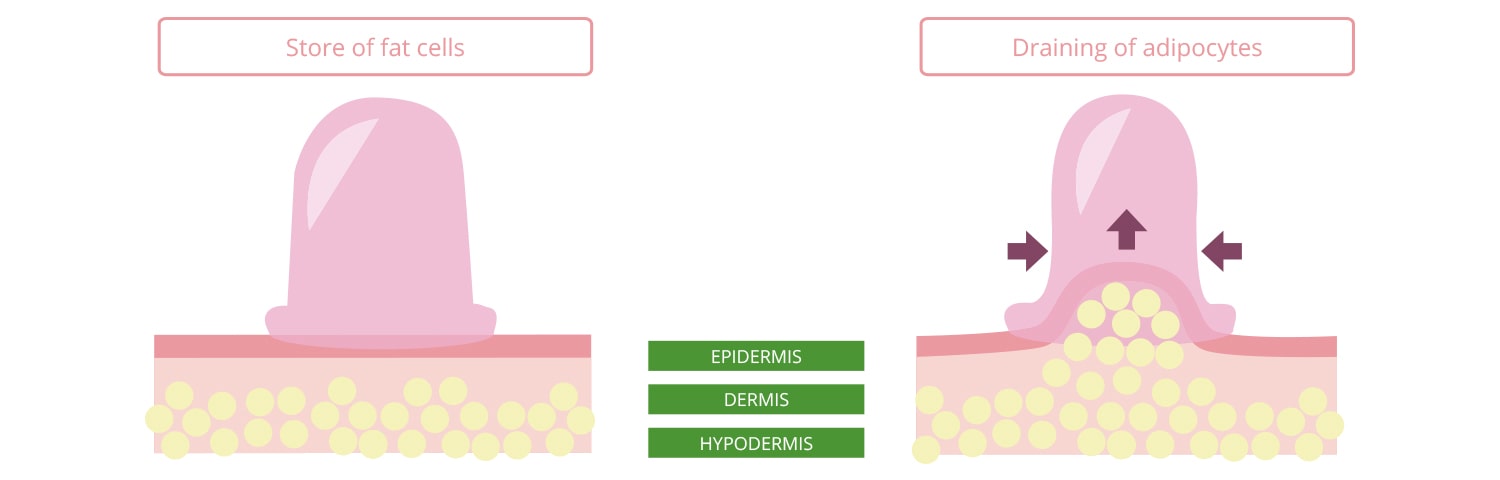 Cellu-Cup-3-min Cellu-Cup Original | Cellu-cup