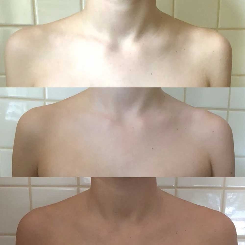 Winter Skin - Moisturiser
