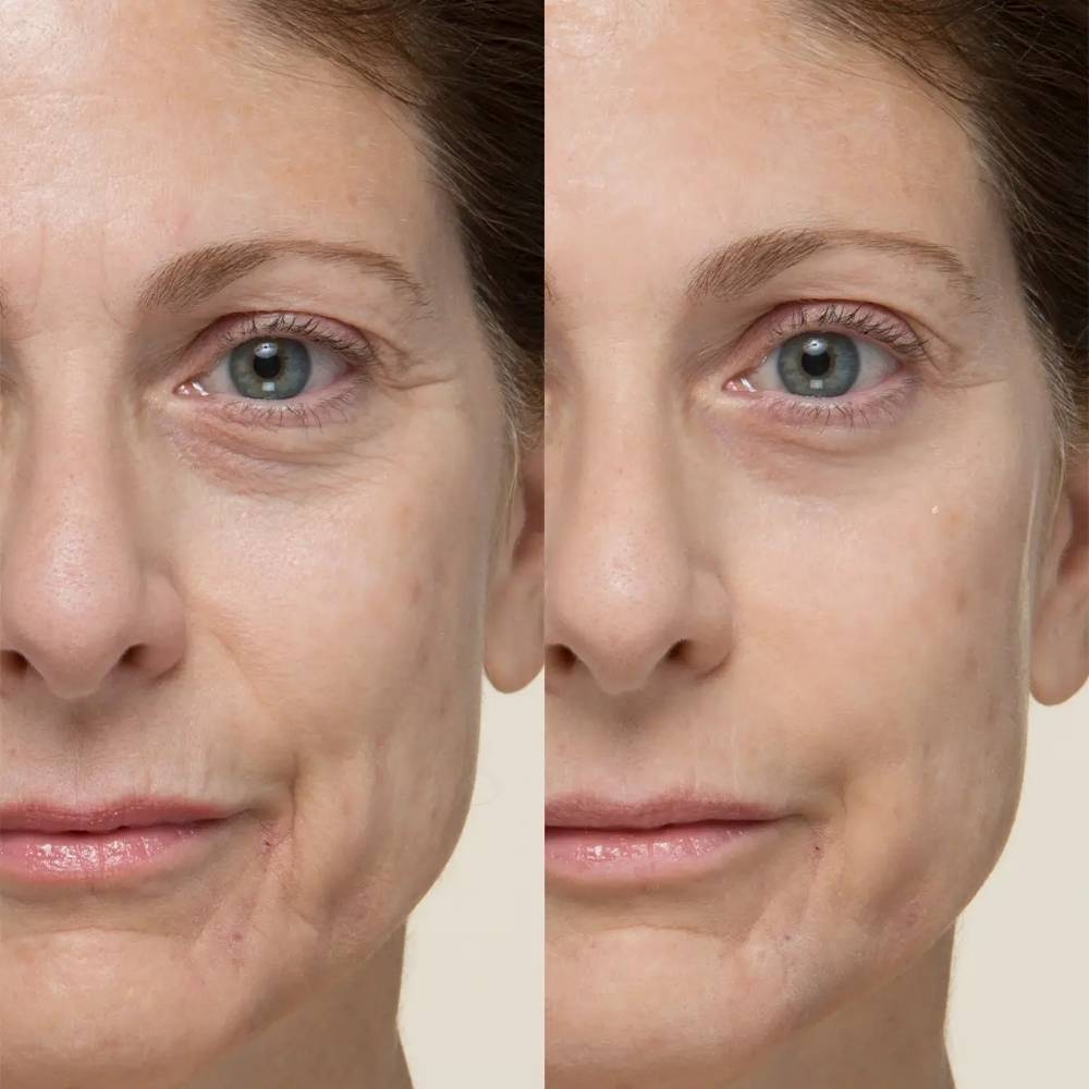 Potent-C Power Eye Cream