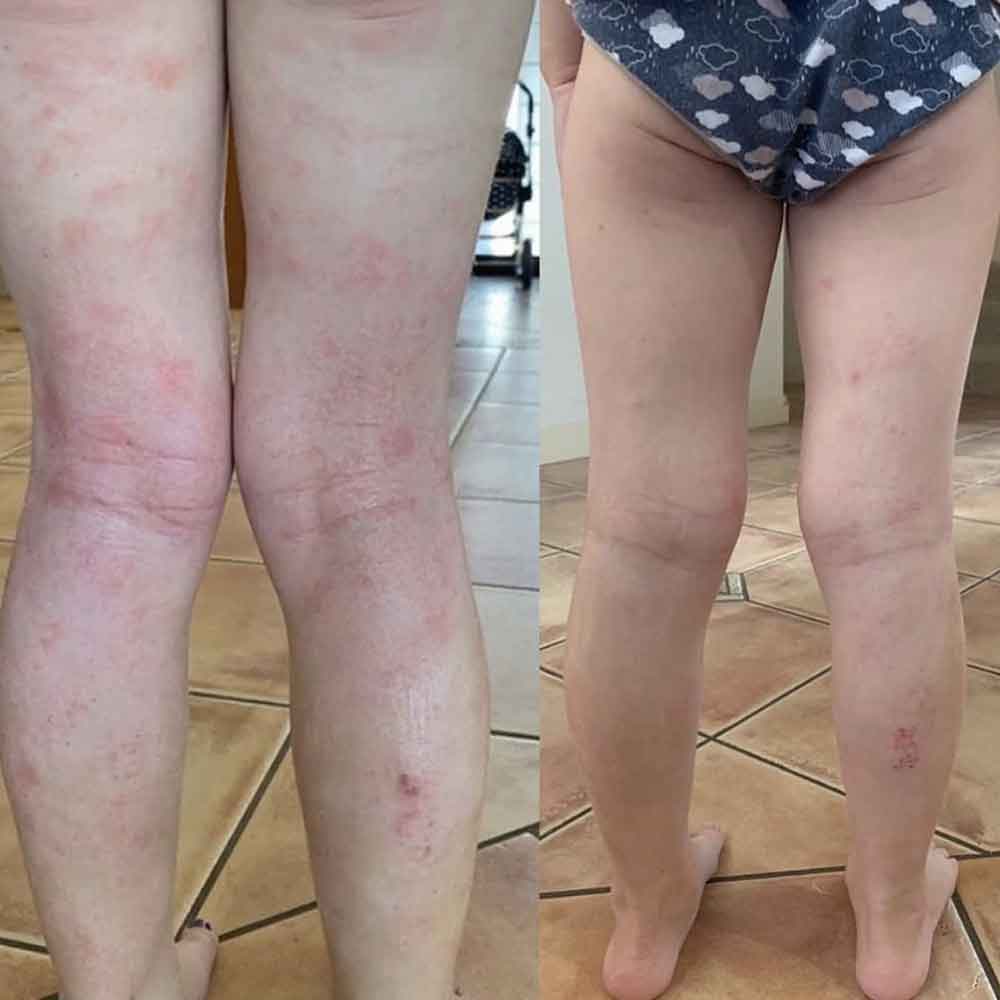 eco-by-sonya-skin-hero-trio-ergebnisse