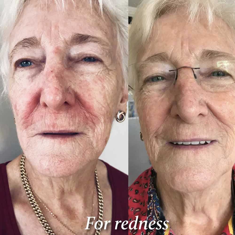 eco-by-sonya-glory-oil-ergebnisse-3