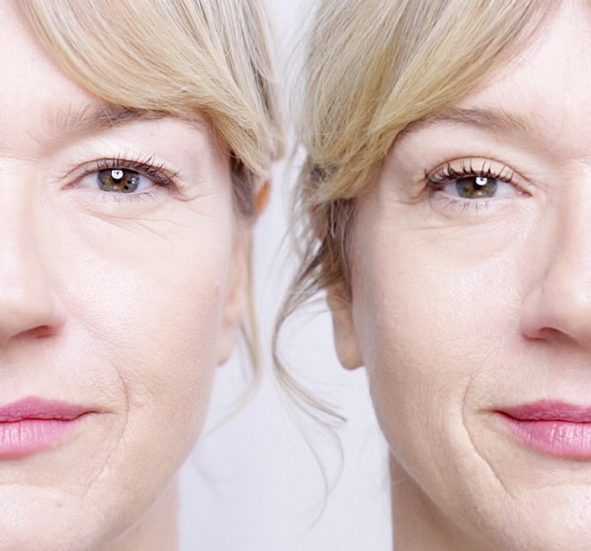 Eyelid Lifting trial | Magicstripes | LOOK BEAUTIFUL PRODUCTS
