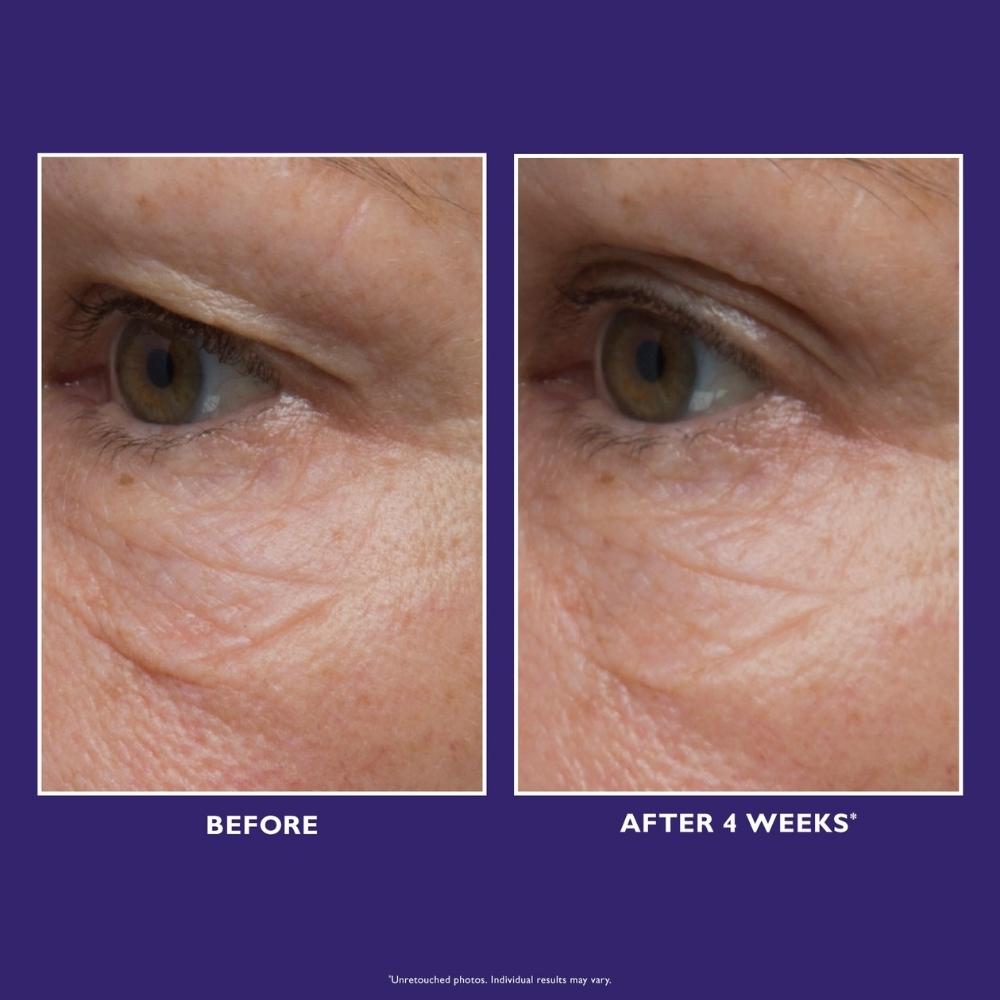 Ultimate Solution 5 Multitasking Eye Cream